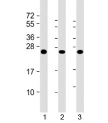 Western blot testing of human 1) A431, 2) HL-60 and 3) U2OS cell lysate with RAB5C antibody at 1:200