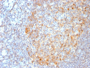 IHC staining of FFPE human tonsil tissue with recombinant MALT1 antibody (clone MT1/3159R). Required