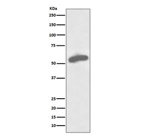 G6PD Antibody / Glucose-6-phosphate dehydrogenase