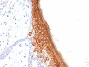 IHC testing of FFPE human skin with recombinant KRT10 antibody (clone rKRT10/844). Required HIER: bo