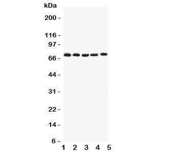 Western blot testing of Kv1.4 antibody and Lane 1: rat brain; 2: human HY1080; 3: (h) PANC; 4: (h) U