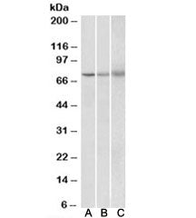 Western blot testing of human [A], mouse [B] and rat [C] spleen lysate with KLHL6 antibody at 2ug/ml