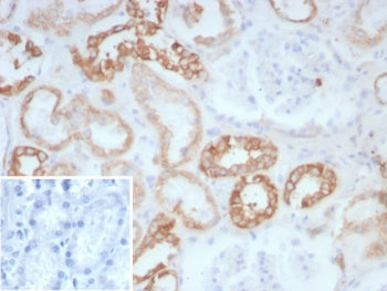 IHC staining of FFPE human kidney tissue with COL2A1 antibody (clone COL2A1/8882R). Inset: PBS used 