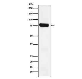 Western blot testing of human Jurkat cell lysate with HEC1 antibody. Expected molecular weight: 74-8