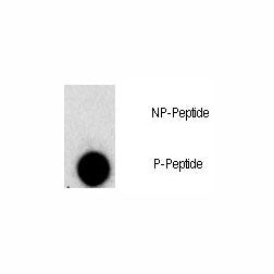 Dot blot analysis of phospho-FGFR1 antibody. 50ng of phos-peptide or nonphos-peptide per dot were sp