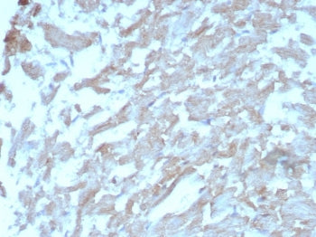 IHC staining of FFPE human heart tissue with FABP3 antibody (clone FABP3/8442). HIER: boil tissue se