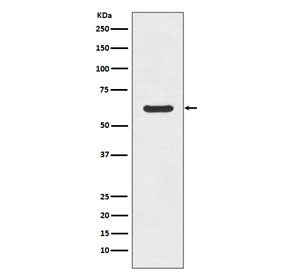 Western blot testing of human K562 cell lysate with Asparagine Synthetase antibody. Predicted molecu