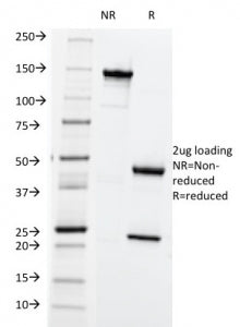 HLA-ABC Antibody (MHC I)