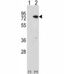 Western blot analysis of MeCP2 antibody and 293 cell lysate (2 ug/lane) either nontransfected (Lane 