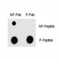 Dot blot analysis of phospho-MEF2C antibody and nonphos MEF2C Ab. 50ng of phos-peptide or nonphos-pe