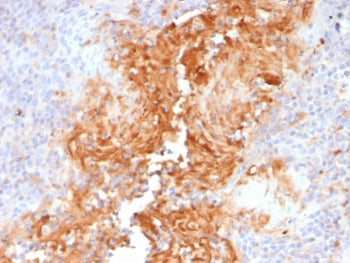 IHC staining of FFPE human tonsil tissue with Alpha-1-Antitrypsin antibody (clone AAT/4490). HIER: b
