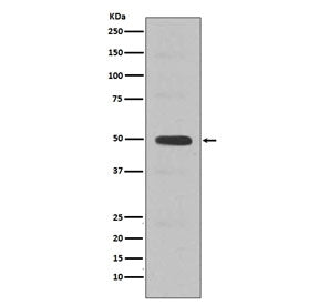 Western blot testing of human Jurkat cell lysate with CCNE2 antibody. Expected molecular weight: 45-