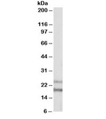 Western blot testing of human frontal cortex lysate with IL-22 antibody at 1ug/ml. Observed molecula