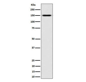 Western blot testing of human K562 cell lysate with NKCC2 antibody. Expected molecular weight: 121-1