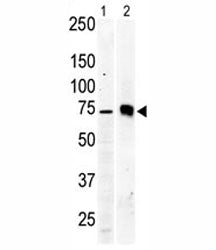 Western blot testing of PKC beta 2 antibody and Jurkat cell lysate (lane 1) and mouse brain tissue l