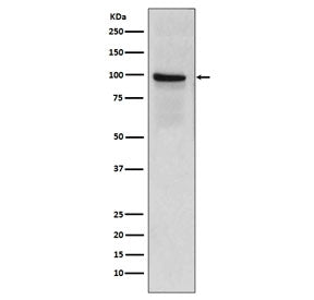 Western blot testing of human placenta lysate with CD141 antibody. Expected molecular weight: 60-100