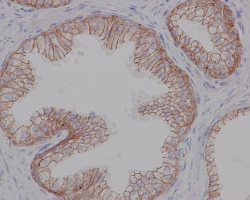 IHC testing of FFPE human prostate with Beta 2 Adrenergic Receptor antibody at 2ug/ml. HIER: steamed