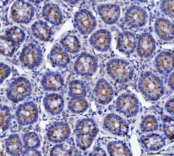 MUC5AC Antibody / Mucin-5AC