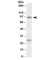 Western blot testing of human kidney lysate with SLC4A11 antibody at 0.3ug/ml. The expected ~95kDa b