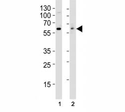 Western blot analysis of lysate from (1) HT29 and (2) Jurkat cell line using anti-Src antibody at 1: