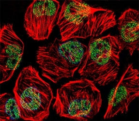 Fluorescent confocal image of U251 cell stained with TBP antibody at 1:25. TBP immunoreactivity is l