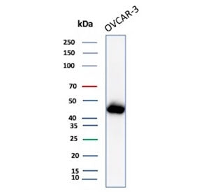 Western blot testing of human OVCAR-3 cell lysate with Mesothelin antibody (clone MSLN/3383). Predic