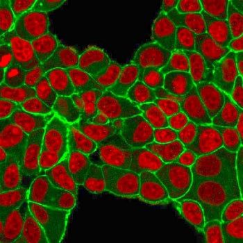 HER2 Antibody / ErbB2