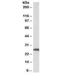 Western blot testing of human adipose tissue lysate with CFD antibody at 1ug/ml. Predicted molecular