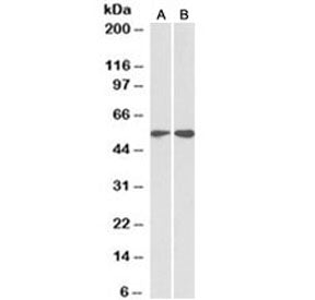 Vimentin Antibody