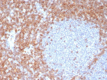 IHC staining of FFPE human tonsil tissue with CD7 antibody (clone CD7/8118R). HIER: boil tissue sect