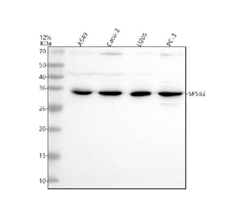 Western blot analysis of SPSB2 using anti-SPSB2 antibody. Electrophoresis was performed on a 12% SDS