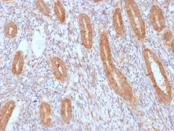 IHC staining of FFPE human endometrium with recombinant COX2 antibody. HIER: boil tissue sections in