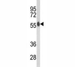 Western blot analysis of AKT2 antibody and mouse brain tissue lysate. Predicted molecular weight: ~5