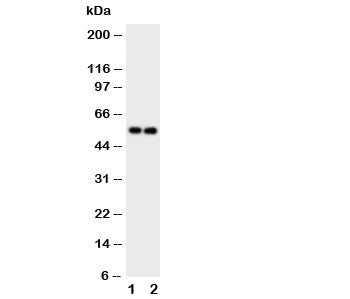 Western blot testing of GABA A Receptor alpha 1 antibody and Lane 1: rat brain; 2: rat brain tissue 
