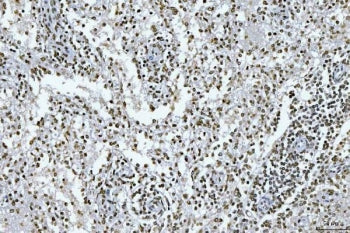 GADD45B Antibody