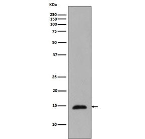 Western blot testing of lysate from Methyl methanesulfonate-treated Saccharomyces cerevisiae with ph
