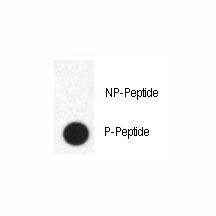 Phospho-FABP4 Antibody (pY20)