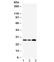 RPL19 Antibody / Ribosomal protein L19