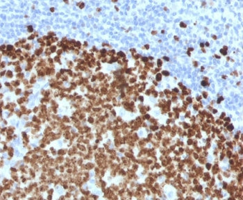 IHC testing of FFPE human tonsil and Thymidylate Synthase antibody (clone TYSY9-2). HIER: boil tissu