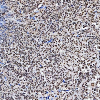 SF3a60 Antibody / SAP 61 / Splicing factor 3A subunit 3