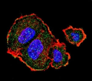Confocal immunofluorescent analysis of p-Tuberin antibody with MCF-7 cells followed by Alexa Fluor 4