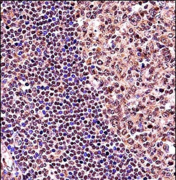 IHC testing of FFPE human tonsil tissue with TCF3 antibody. HIER: steam section in pH6 citrate buffe