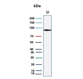 Western blot testing of human small intestine tissue lysate with LI-Cadherin antibody (clone CDH17/2