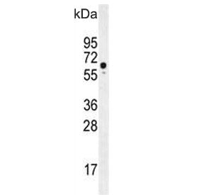 Western blot testing of human HeLa cell lysate with WDR70 antibody. Expected molecular weight ~70 kD