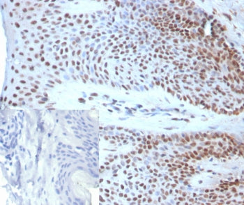 IHC staining of FFPE human skin tissue with SOX18 antibody (clone SOX18/3271). Inset: PBS used in pl