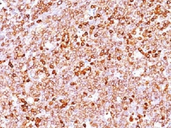 IHC testing of FFPE human tonsil with recombinant CD79a antibody (clone IGA/1688R). Required HIER: b