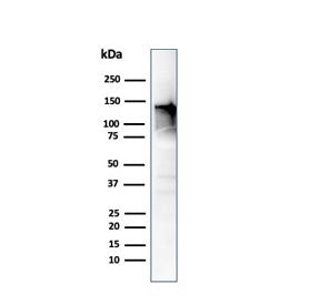 Western blot testing of human ovary tissue lysate using CAD antibody (clone CALD1/820). Predicted mo