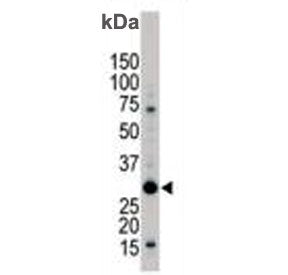 Western blot testing of human Jurkat cell lysate with YWHAB antibody. Predicted molecular weight ~28