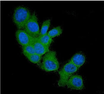 Immunofluorescent staining of FFPE human MCF7 cells with FHIT antibody (green) and DAPI nuclear stai