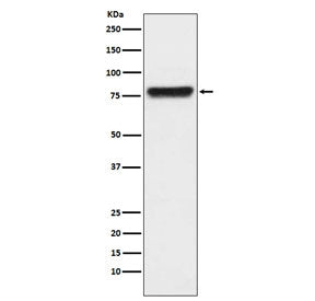 Western blot testing of human plasma lysate with Plasma Kallikrein antibody. Predicted molecular wei